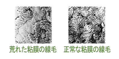 senmou.gif